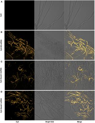Host-Induced Gene Silencing of a Sclerotinia sclerotiorum <mark class="highlighted">oxaloacetate</mark> acetylhydrolase Using Bean Pod Mottle Virus as a Vehicle Reduces Disease on Soybean